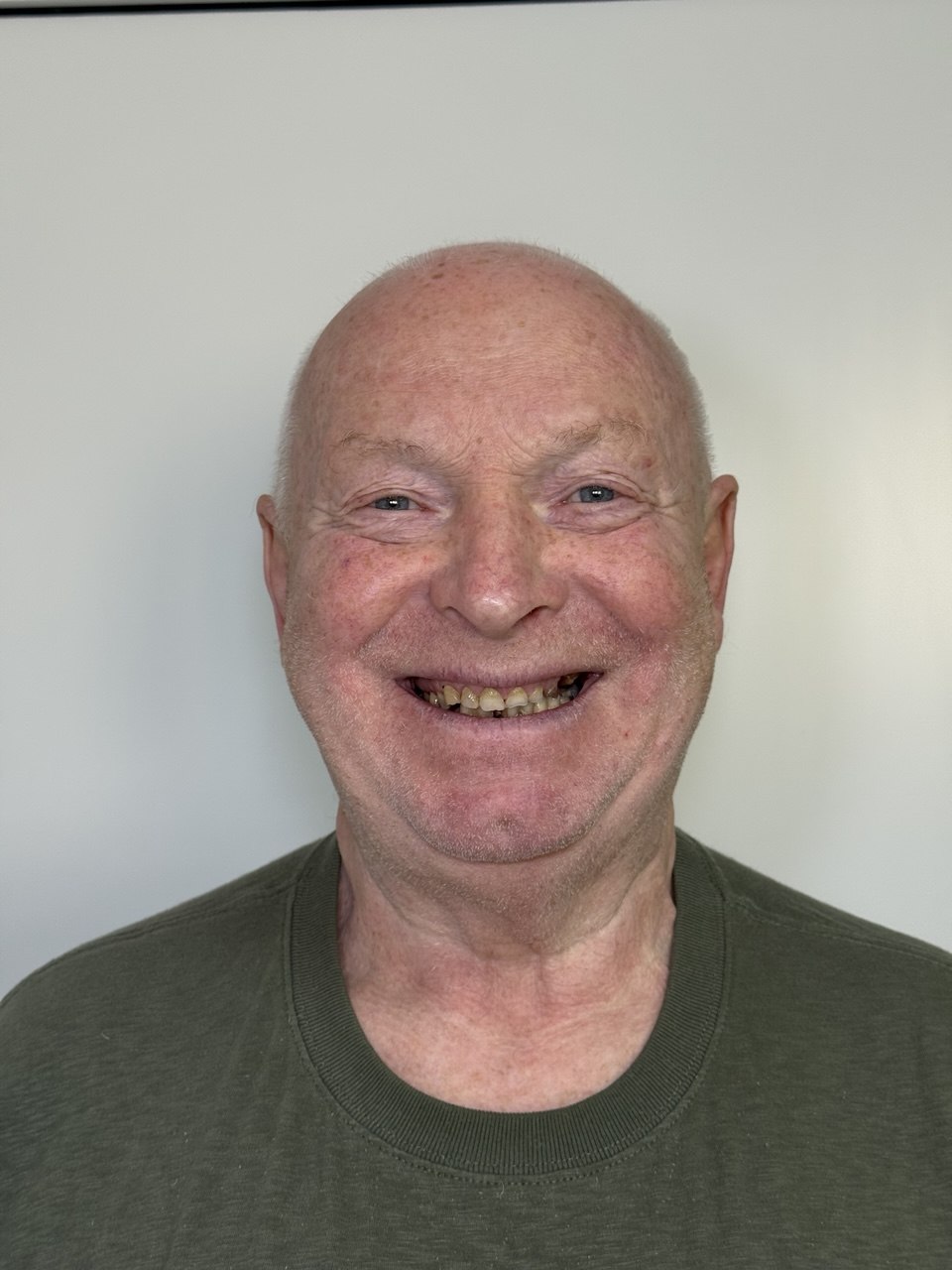 Vorher – Patient 1