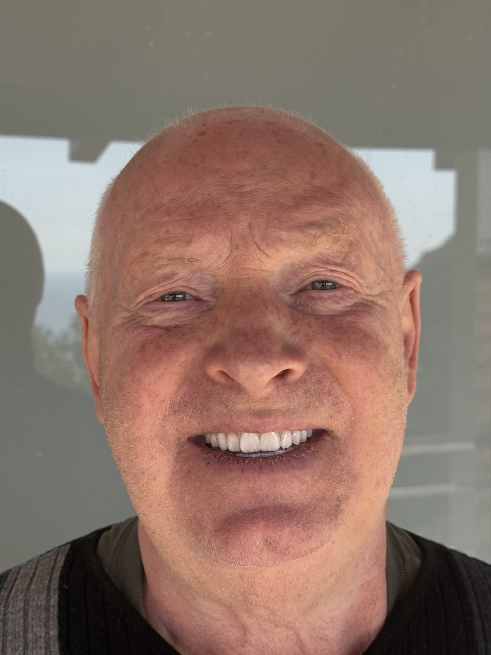 Nachher – Patient 1