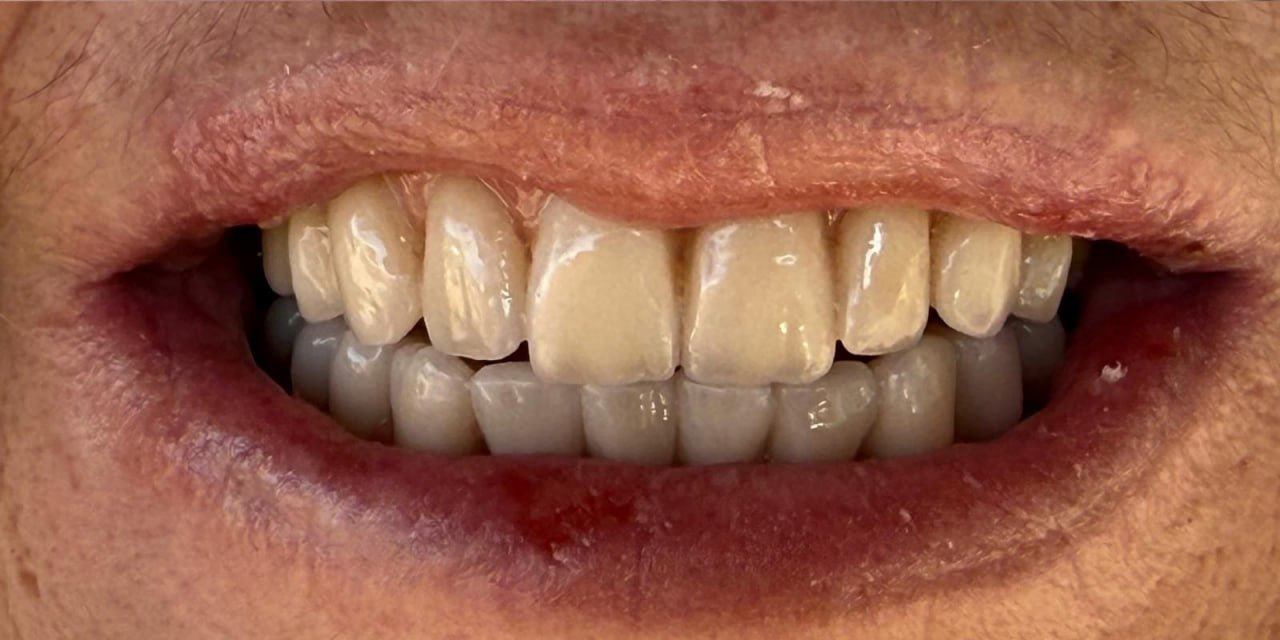 Nachher – Patient 3